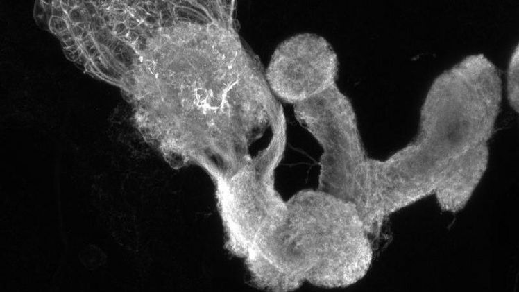 In diesem Teil des Gehirns der Fruchtfliegenlarve werden Gedächtnisse gespeichert. Bild: Dr. Mareike Selcho/Universität Würzburg. In diesem Teil des Gehirns der Fruchtfliegenlarve werden Gedächtnisse gespeichert. Bild: Dr. Mareike Selcho/Universität Würzburg.