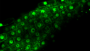 Konfokale Mikroskopie von Arabidopsis-Pflanzen, die NAC53 mit einem GFP exprimieren. Bild:© Suayb Üstün.