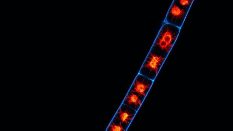 In der Jochalge Zygnema circumcarinatum fand das Forschungsteam ein Gen, das bei der Stressbewältigung eine Rolle spielen könnte. Bild: Universität Göttingen.