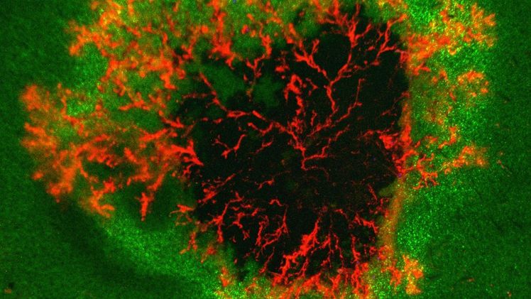 Infektionsstelle des Erregers der Knollenfäule Phytophthora infestans auf einem Blatt. Die sich ausbreitenden Erregerhyphen sind rot-fluoreszierend markiert. Lebendes Blattgewebe ist grün, abgestorbenes Gewebe ist dunkel. Bild: Sebastian Schornack / Sainsbury Laboratory, Norwich Research Park, CC BY 4.0.