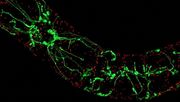 Pflanzen zeigen der Hitze den „Finger“: Geraten Pflanze durch hohe Temperaturen oder Trockenheit in Stress, bilden sich im Innern der Zellen Ausstülpungen, die Schutzprogramme auslösen. Bild: © Toranj Rahpeyma, KIT.