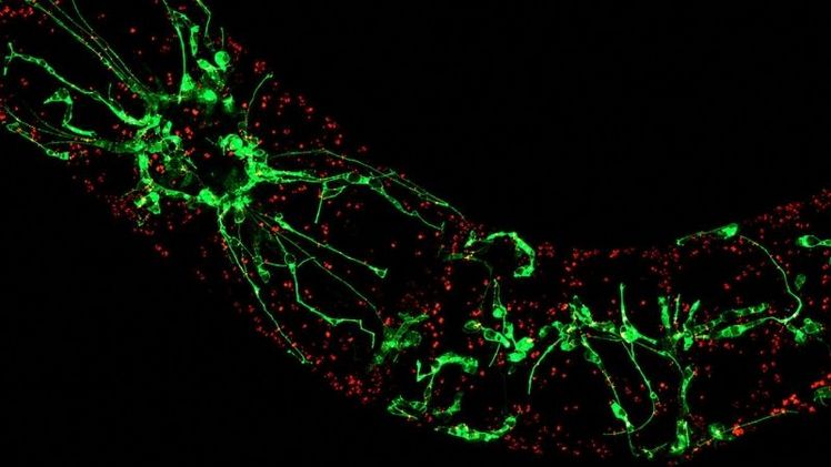 Pflanzen zeigen der Hitze den „Finger“: Geraten Pflanze durch hohe Temperaturen oder Trockenheit in Stress, bilden sich im Innern der Zellen Ausstülpungen, die Schutzprogramme auslösen. Bild: © Toranj Rahpeyma, KIT.