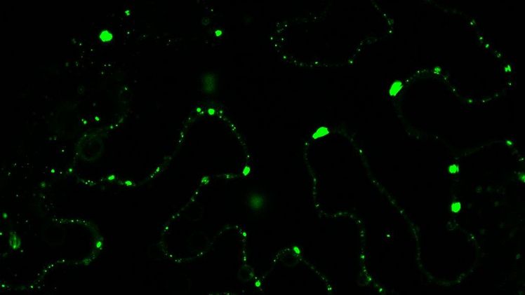 Im mikroskopischen Bild wurden die Komponenten zum Leuchten gebracht, die in den Zellen der Tabakpflanze an der Autophagie beteiligt sind und durch krankheitserregende Xanthomonas-Bakterien abgebaut werden. Bild:  Suayb Üstün / Universität Tübingen.