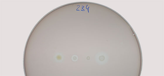 Hemmhöfe in einem Bakterienrasen verursacht durch verschiedene Bakterienstämme. Bild: E.J.N. et al. Hemmhöfe in einem Bakterienrasen verursacht durch verschiedene Bakterienstämme. Bild: E.J.N. et al.